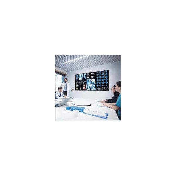 Samsung QB55C - 55" дисплей с DICOM стандарт за ехографски снимки